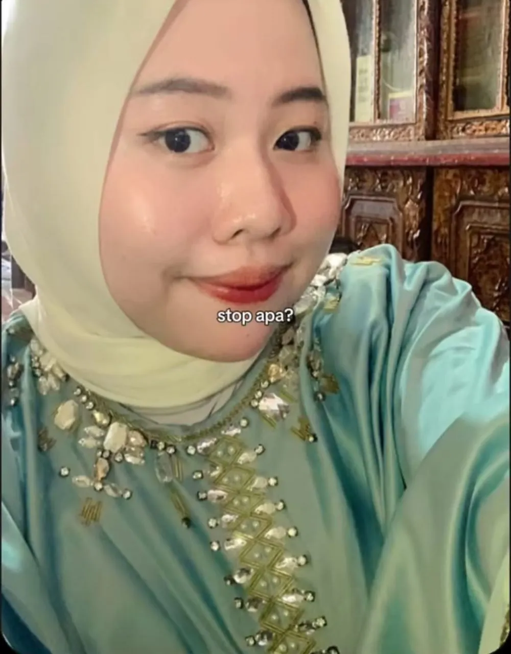 terkena bells palsy © TikTok terkena bells palsy © TikTok