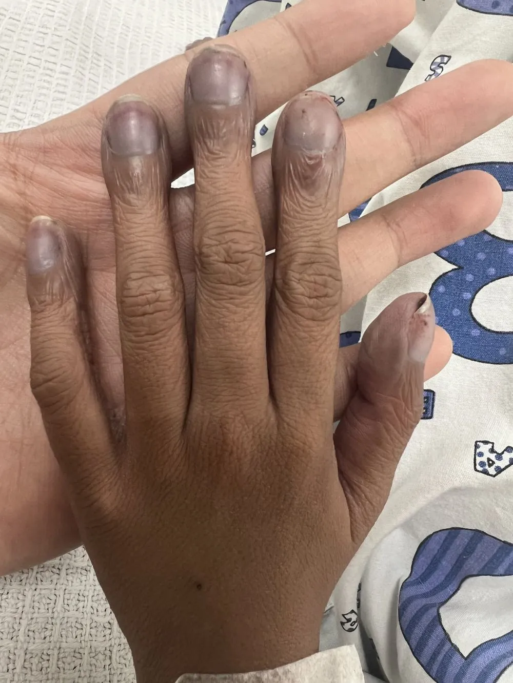 Kondisi perubahan kuku berbagai sumber 