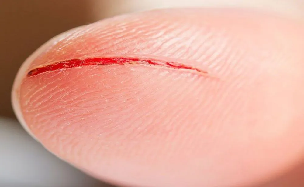 Risiko penyakit akibat penggunaan tato abal-abal © 2024 brilio.net