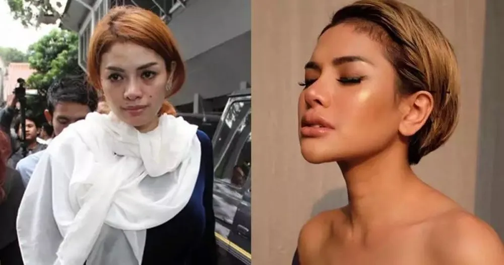 Seleb pilih oplas meski sudah cantik alami Berbagai sumber