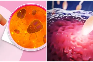 Jangan diabaikan, ini 7 ciri-ciri tubuh anak terjangkit cacingan, bisa ganggu tumbuh kembang