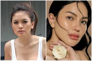 11 Seleb ini rela habiskan biaya fantastis untuk oplas, Nikita Mirzani habiskan hingga Rp 1 miliar