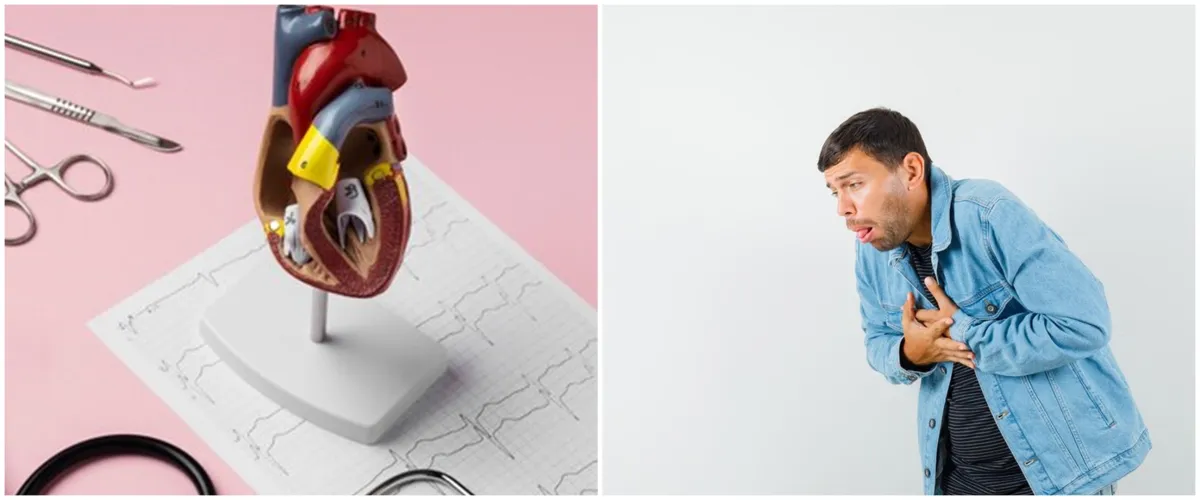 Bisa sebabkan stroke, ini 6 cara deteksi dini atrial fibrilasi, penyebab, dan cara mengobatinya