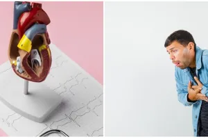 Bisa sebabkan stroke, ini 6 cara deteksi dini atrial fibrilasi, penyebab, dan cara mengobatinya