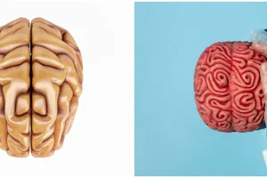 Mikroplastik ditemukan di otak manusia, kenali penyebab, risiko, dan dampaknya untuk kesehatan