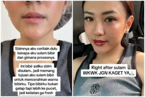 Niat cantik malah menyesal, kisah cewek usai sulam bibir ini berujung idap penyakit seumur hidup
