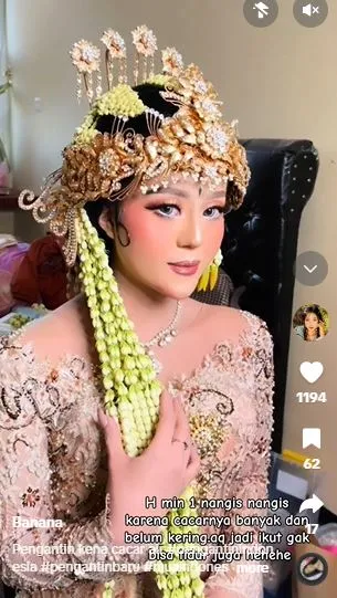 Transformasi wajah cewek penuh bekas luka hasilnya jadi mulus pol TikTok