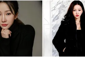 Lucinta Luna akui ketagihan operasi plastik meski taruhannya nyawa, ternyata ini alasannya