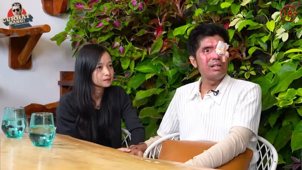 kontroversi kasus Agus Salim korban air keras © 2024 brilio.net