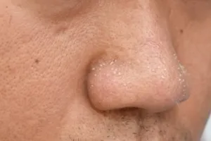 Trik ampuh bersihkan pori-pori wajah agar kembali rapat, cuma andalkan 1 jenis ampas minuman