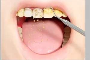 Tanpa garam atau lemon, begini cara bikin gigi putih berkilau cuma pakai 2 bahan dapur