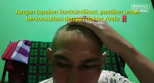 trik menghilangkan rambut beruban  berbagai sumber