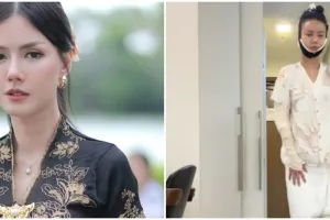 Sudah cantik tetap oplas, 9 potret Nita Gunawan jalani transfer lemak biar wajah tidak kempot