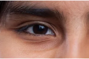 Cara mudah dan alami menghilangkan mata panda ini bantu samarkan garis halus meski tanpa eye cream