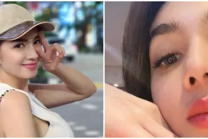 Pilih oplas meski sudah cantik alami, begini potret 11 seleb sebelum dan sesudahnya