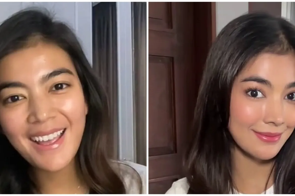 13 Seleb ini pilih oplas meski sudah cantik alami, ini potret sebelum dan sesudahnya