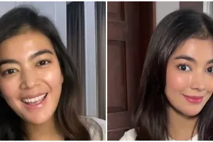 13 Seleb ini pilih oplas meski sudah cantik alami, ini potret sebelum dan sesudahnya