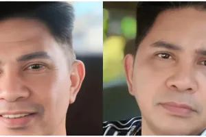 7 Potret Ronny Sianturi sebelum & sesudah operasi plastik di usia 60, wajah menolak tua, antikerutan