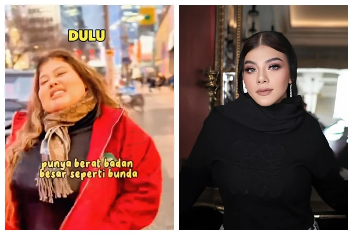 9 Potret wajah Shindy Samuel sebelum dan sesudah operasi plastik, perubahannya bak beda orang