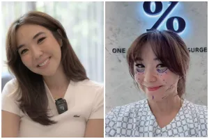 Gisella Anastasia jalani oplas ke Korea, netizen sebut sudah cantik tapi masih permak wajah