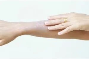 Cara mudah bikin racikan alami ampuh meratakan warna kulit tangan belang, cuma pakai 1 bahan pemanis