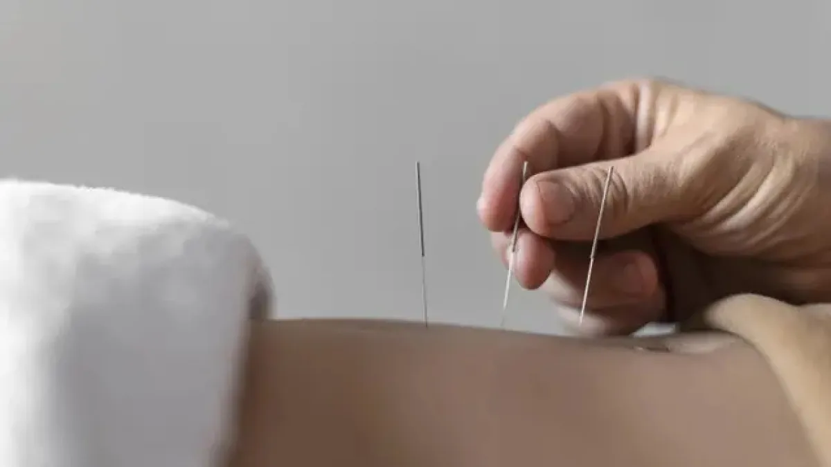 Kisah pria kena infeksi bakteri pemakan daging usai jalani akupunktur, endingnya bikin tragis