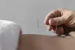 Kisah pria kena infeksi bakteri pemakan daging usai jalani akupunktur, endingnya bikin tragis