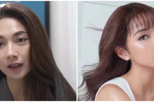 9 Transformasi Dinda Kirana jalani oplas wajah dan badan, hasilnya natural dan tampak lebih muda