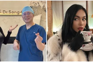 Sengaja operasi plastik kedua untuk cari suami, intip 9 potret penampilan terbaru Denada