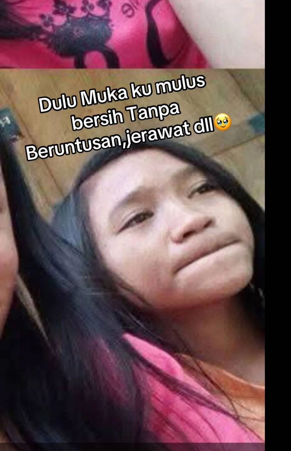 wajah wanita mulus jadi penuh bopeng © TikTok wajah wanita mulus jadi penuh bopeng © TikTok