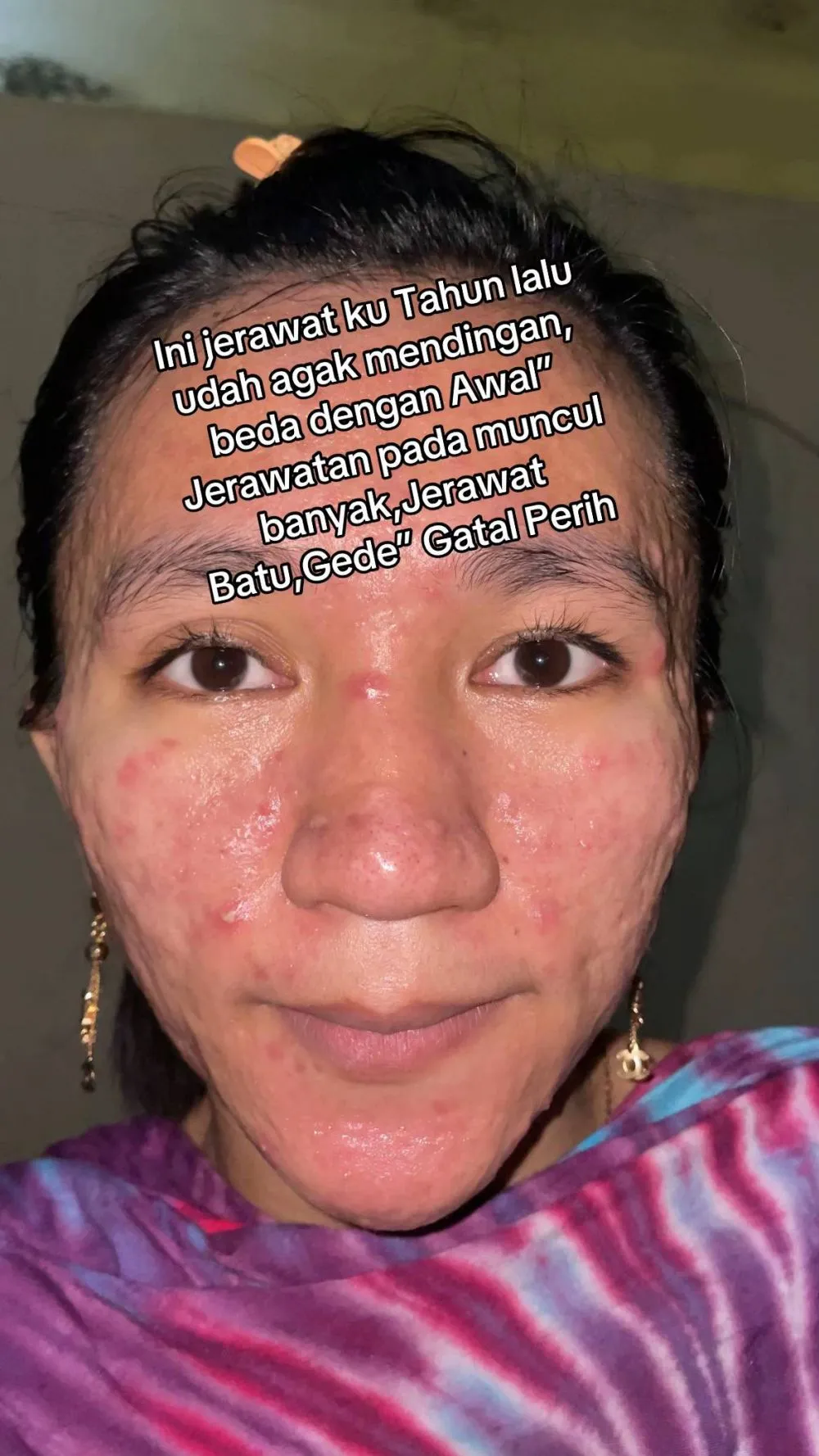 wajah wanita mulus jadi penuh bopeng © TikTok wajah wanita mulus jadi penuh bopeng © TikTok