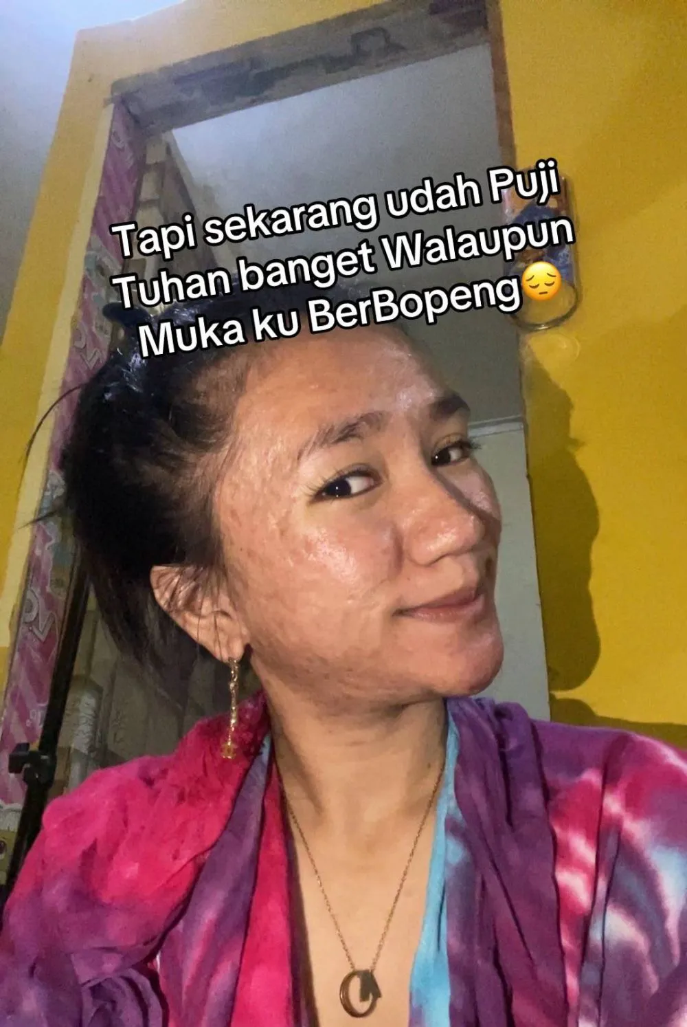 wajah wanita mulus jadi penuh bopeng © TikTok wajah wanita mulus jadi penuh bopeng © TikTok