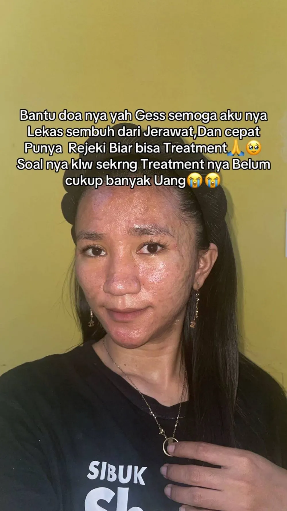 wajah wanita mulus jadi penuh bopeng © TikTok wajah wanita mulus jadi penuh bopeng © TikTok