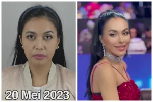 9 Potret transformasi Denada usai oplas di Thailand, hidung mancungnya bikin pangling