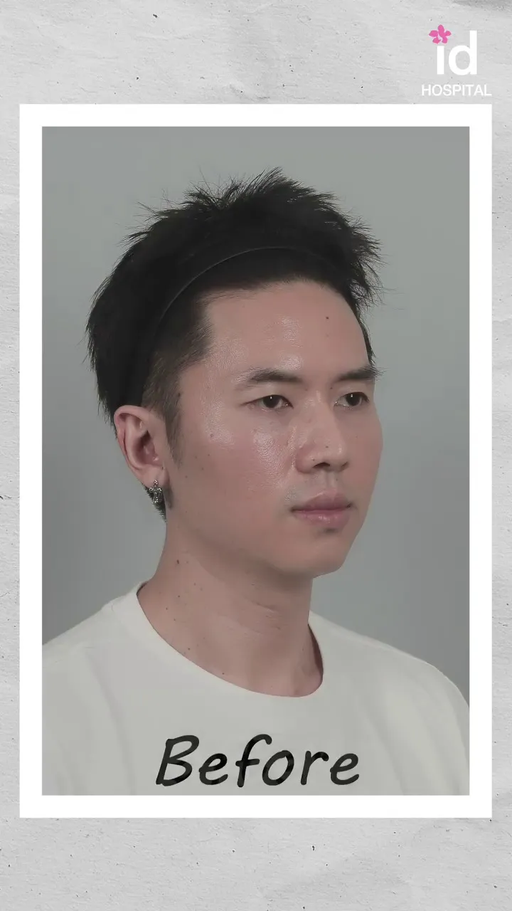 Rafael Tan operasi plastik © 2025 Instagram Rafael Tan operasi plastik © 2025 Instagram