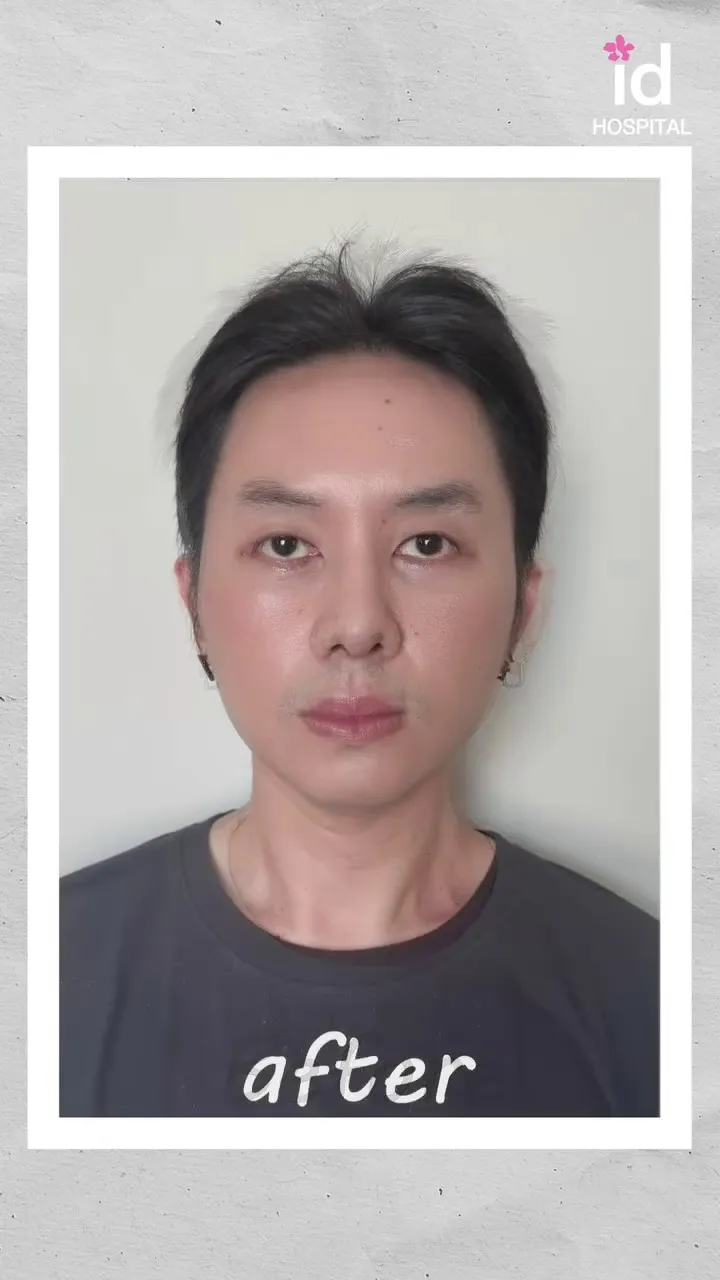 Rafael Tan operasi plastik © 2025 Instagram Rafael Tan operasi plastik © 2025 Instagram