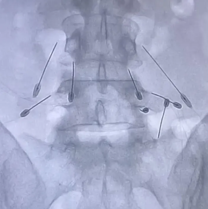 Potret Ferry Maryadi dirawat di rumah sakit © 2025 brilio.net
