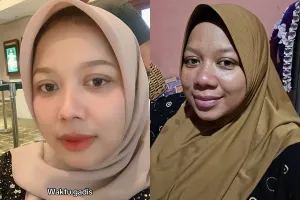 Bak flamingo kehilangan warna pink-nya, ini alasan kenapa wanita alami perubahan fisik usai melahirkan