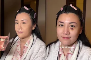 Punya bekas memar di wajah, MUA ini sukses bikin wajah pengantin jadi flawless bak princess