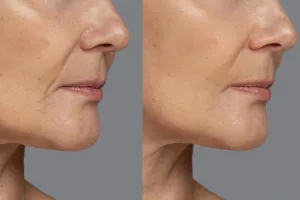 Cuma butuh 3 jenis buah, ini cara bikin minuman kolagen untuk kencangkan kulit dan hempaskan kerutan