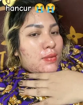 potret lawas Mira Hayati © TikTok