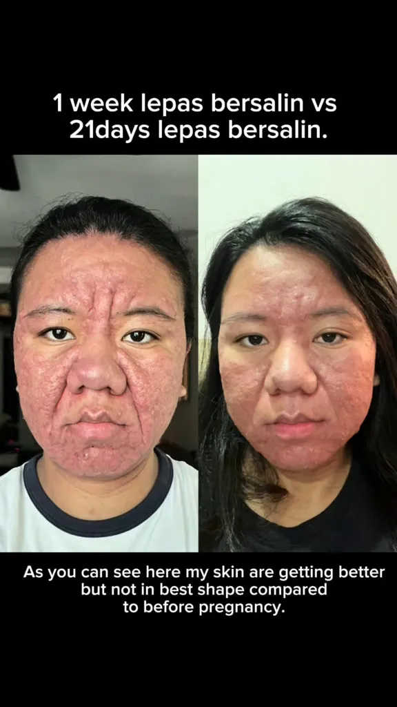 Usaha ibu hamil perbaiki wajah karena kehamilan © 2025 TikTok Usaha ibu hamil perbaiki wajah karena kehamilan © 2025 TikTok