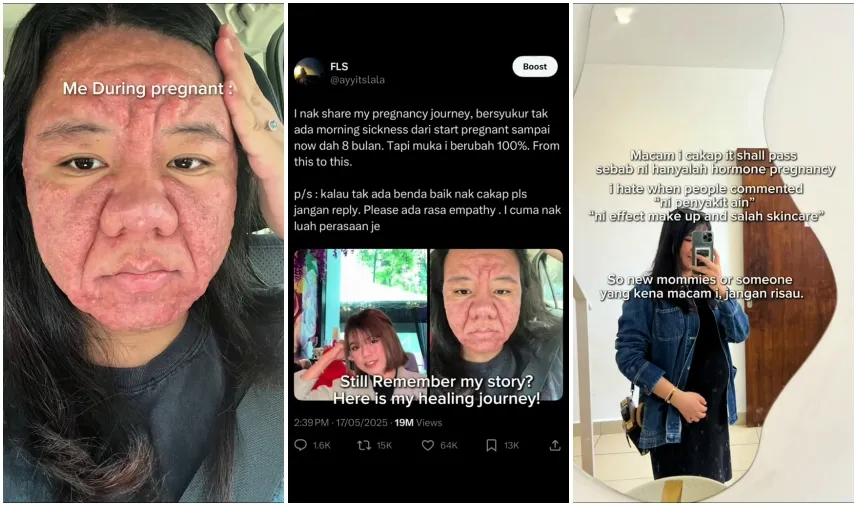 Usaha ibu hamil perbaiki wajah karena kehamilan © 2025 TikTok Usaha ibu hamil perbaiki wajah karena kehamilan © 2025 TikTok