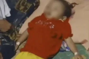 Nasib tragis, Raya balita 3 tahun, tubuh dan otak penuh cacing, orang tua ODGJ, tak punya BPJS