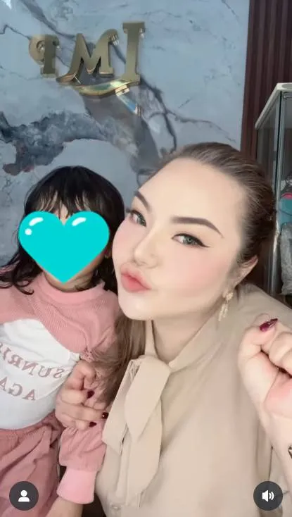 Hasil tes DNA Ridwan Kamil tidak cocok © 2025 berbagai sumber