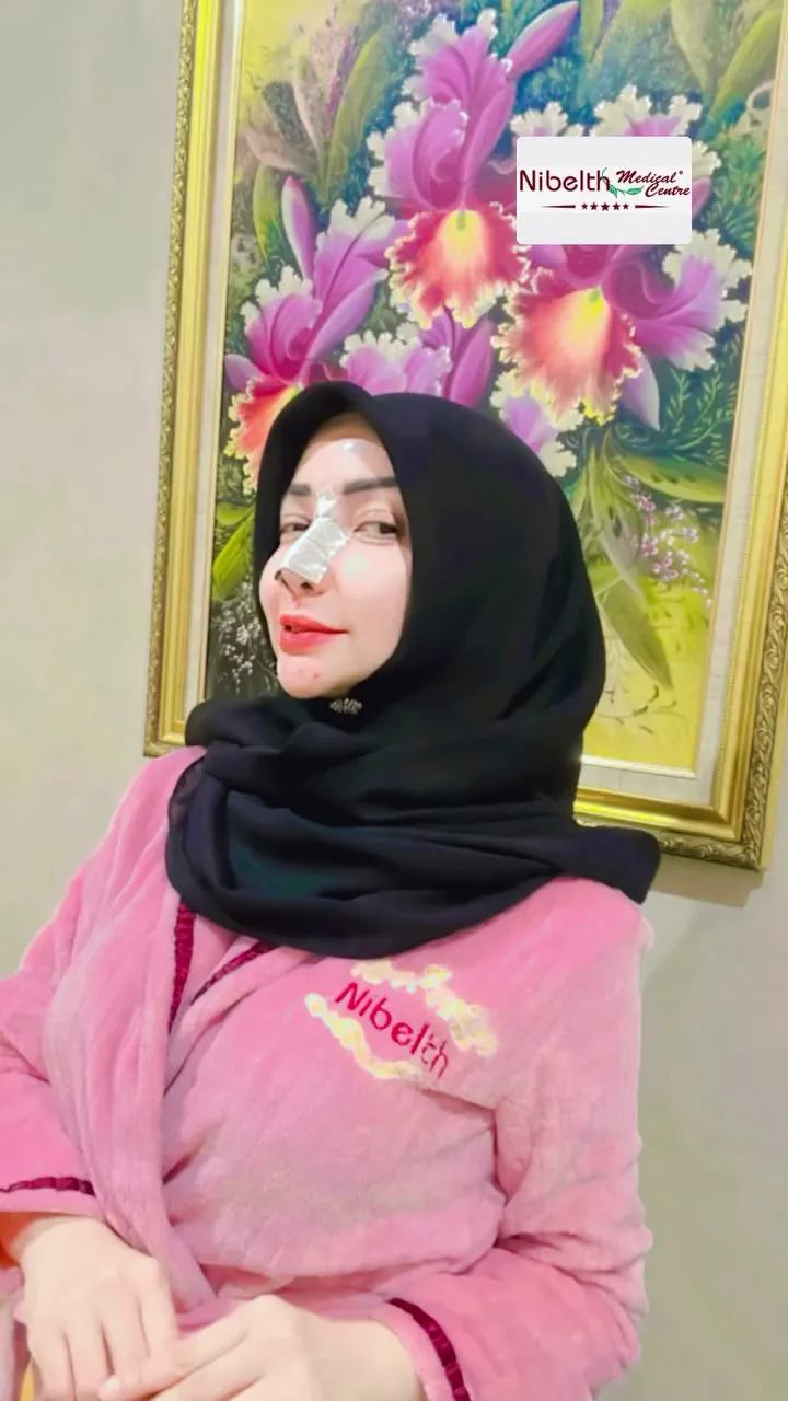 Roro Fitria operasi plastik hidung © 2025 Instagram Roro Fitria operasi plastik hidung © 2025 Instagram
