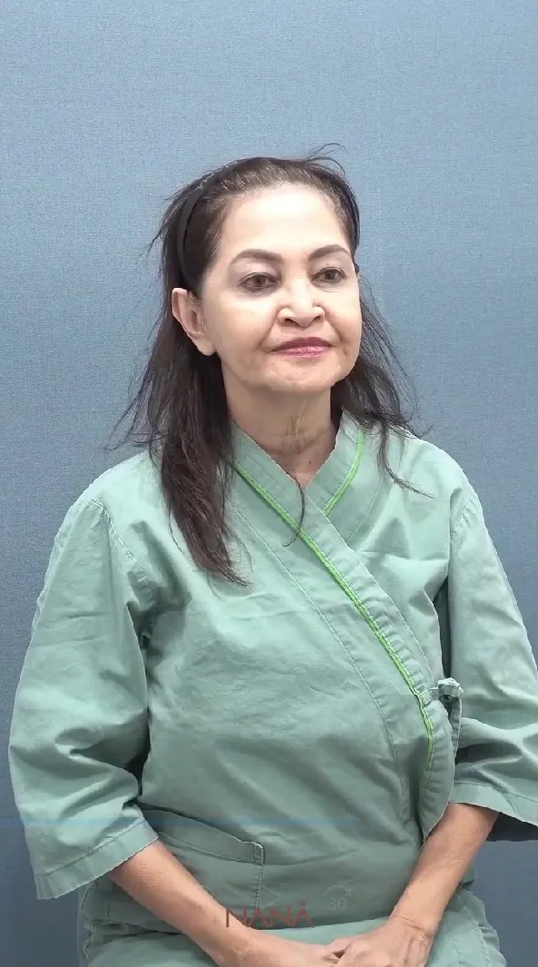 ibunda Nia Ramadhani oplas © Instagram ibunda Nia Ramadhani oplas © Instagram