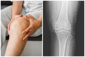 Bikin syok, dokter ini temukan benang susuk emas di lutut pasien saat lakukan rontgen