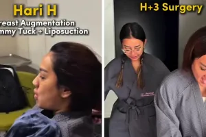 9 Potret Tengku Dewi jalani operasi estetika tubuh di Korea, habiskan ratusan juta, kini kian singset