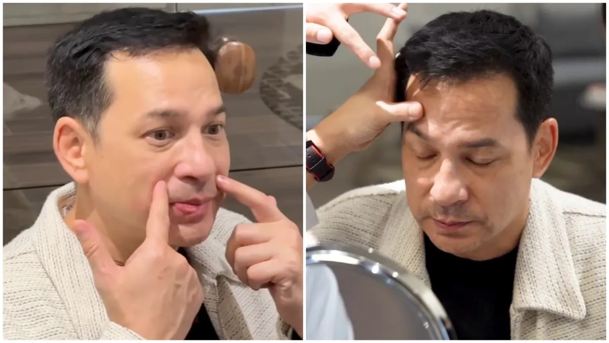 Emoh wajahnya keriput di usia lebih setengah abad, ini 9 potret Ari Wibowo oplas antiaging di Korea